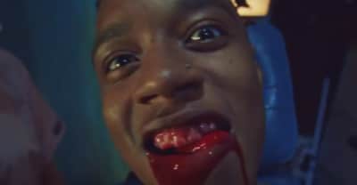 Rejjie Snow Pays A Bloody Trip To The Dentist In His “Pink Beetle” Video