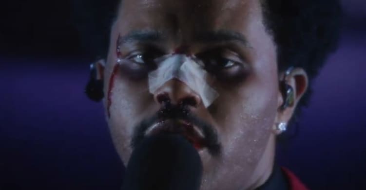 The Weeknd sports bloody makeup and bandaged nose on his way to