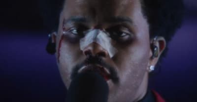 Watch a bloodied and bruised The Weeknd perform “Blinding Lights” on Kimmel