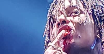 Swae Lee required stitches after being hit by a phone during a Rae Sremmurd show